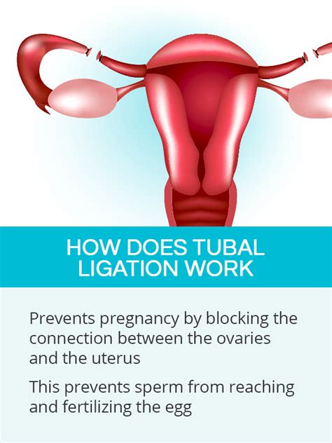 Tubal Ligation Side Effects Weight Gain | Blog Dandk