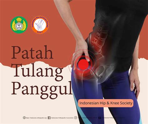 Patah tulang panggul