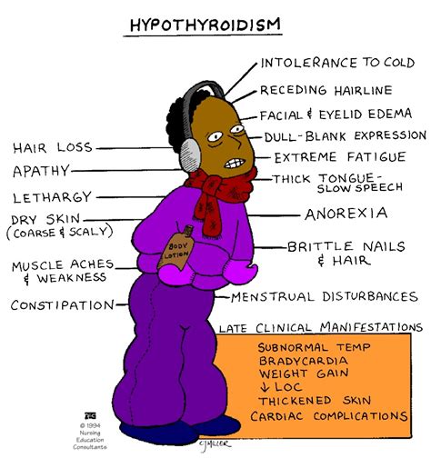 ALL FOR NURSING: MS: Hypothyroidism vs Hyperthyroidism