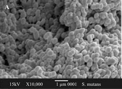 Streptococcus mutans biofilm - microbewiki