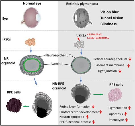 Frontiers | Modeling Retinitis Pigmentosa: Retinal Organoids Generated ...