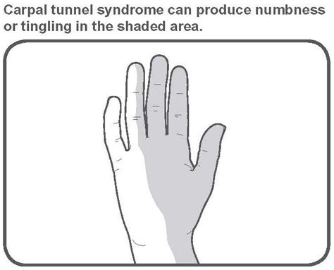 Hand Exercises To Avoid Carpal Tunnel - Exercise Poster