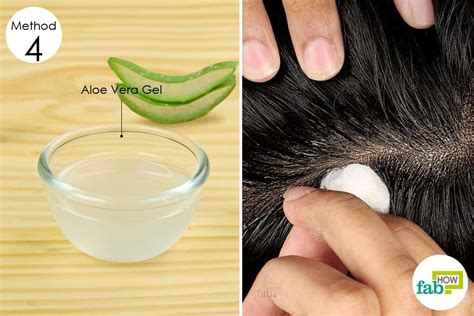 8 Best Home Remedies for Dry, Flaky Scalp That Work | Fab How