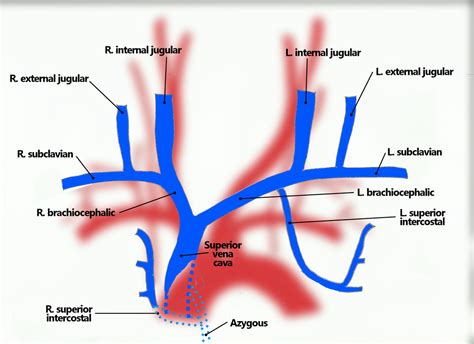 Pin by Andrew Brande on Cardiac Surgery | Ultrasound sonography ...