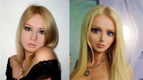 Real Life Barbie Before And After Body