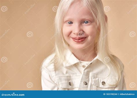 Portrait of Smiling Albino Child Isolated Stock Photo - Image of female ...