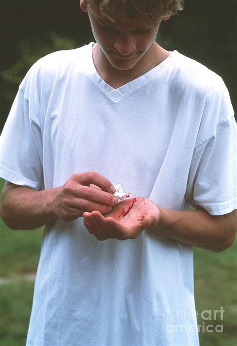 Cut Hand Photograph by Mark Clarke/science Photo Library - Fine Art America