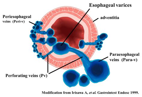 Diagnostics | Free Full-Text | The Role of Endoscopic Ultrasound for ...