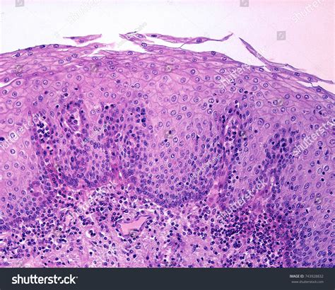 Stratified Squamous Epithelium Non Keratinized Esophagus