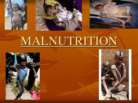 PPT - MALNUTRITION PowerPoint Presentation, free download - ID:432735