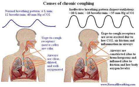 Chronic Cough: Causes and Natural Treatment (90% Success Rate)