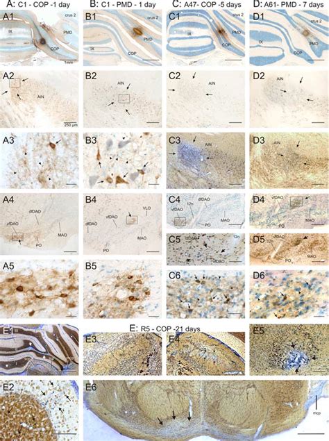 Histological effect of CTb-S injection after various survival times. A ...