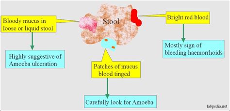 Stool Examination:- Part 1 - Normal Stool Examination Findings - Labpedia.net