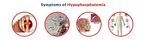 Hypophosphatemia: Causes, Symptoms, Diagnosis and Treatment