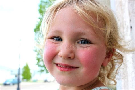 Rosy Cheeks Stock Photos - Download 530 Royalty Free Photos