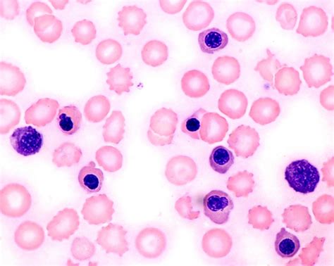 What are Nucleated red blood cell (NRBC)?