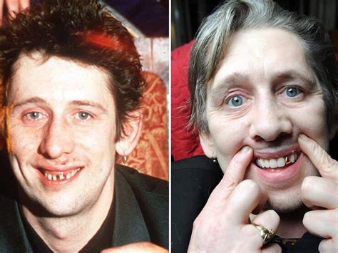 Shane MacGowan of the Pogues [Update: Dead at 65] - Page 2 - DVD Talk Forum