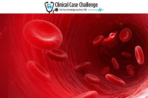 Uncovering the Underlying Cause of Anemia: Making a Myelodysplastic ...