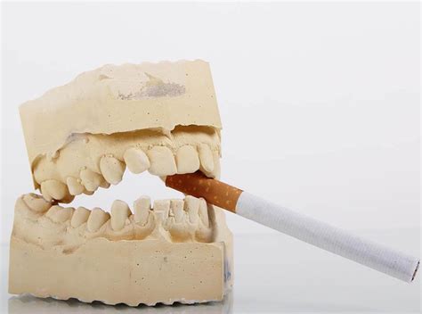 How to Fix Smokers Teeth - Tidatabase