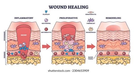 Skin Cell Wound Repair Royalty-Free Images, Stock Photos & Pictures ...