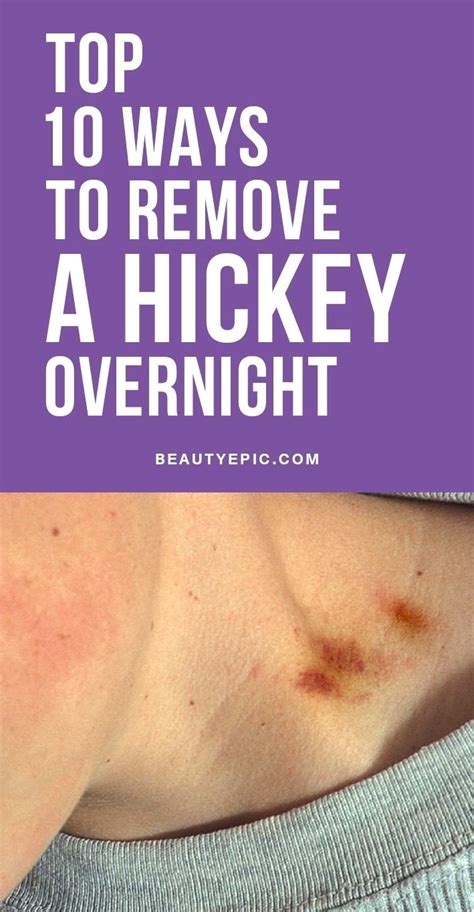 Pin by harry63rux on Home Remedies | Hickeys, How to hide hickeys, Get rid of hickies