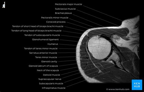 Image Result For Mri Anatomy Shoulder Shoulder Anatomy Supraspinatus | The Best Porn Website