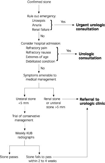 Ureteral Stone With Hydronephrosis And Urolithiasis Alone, 41% OFF