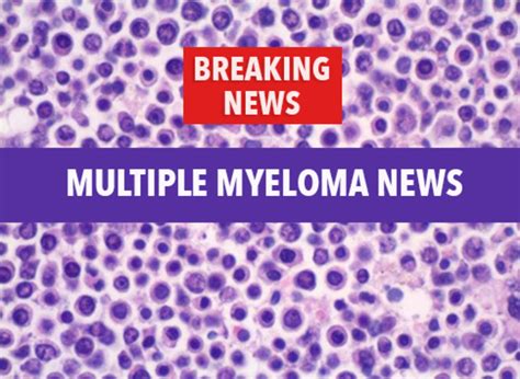 Treatment of Relapsed Myeloma with Second Stem Cell Transplant Appears Safe - CancerConnect