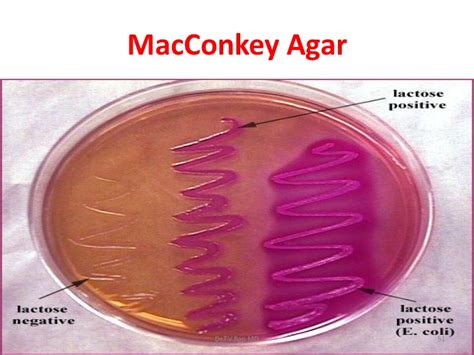 MacConkey Agar : Principles, Composition, Preparation, uses and colony characteristics