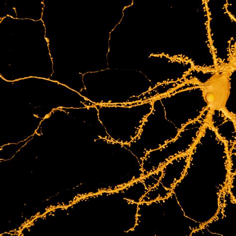 Dendritic Spine Analysis