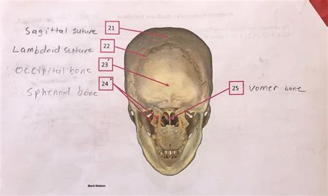 Lambdoidal Suture