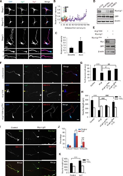 axon development | Semantic Scholar