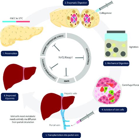 Schematic illustration denoting steps of islet cell transplantation.... | Download Scientific ...