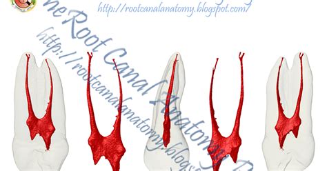 The Root Canal Anatomy Project: Maxillary First Premolar