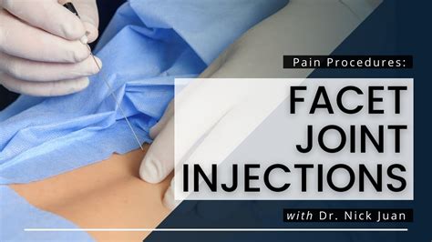 Facet Joint Injections: What You Need To Know - YouTube