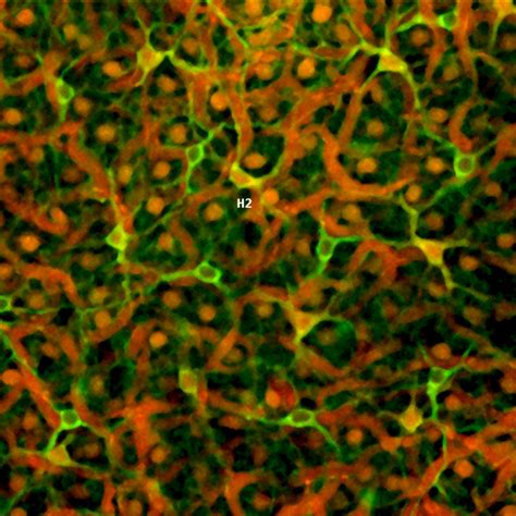 Horizontal cells – Retinal Microscopy