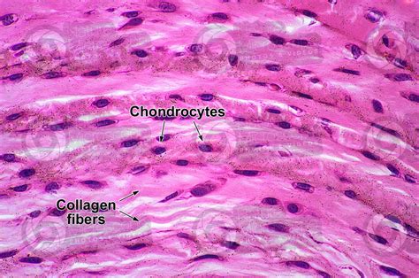 Mammal. Fibrocartilage. Transverse section. 500X - Fibrocartilage - Cartilage - Animal histology ...