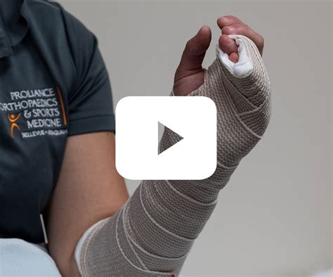 Physician Splinting Guide | Proliance Orthopaedics & Sports Medicine