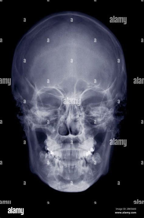 Human skull front view hi-res stock photography and images - Alamy