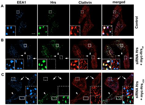 Hrs and its clathrin-box motif are important for recruitment of... | Download Scientific Diagram