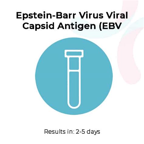 Medical Diagnosis - Epstein-Barr Virus Viral Capsid Antigen (EBV VCA) IgG