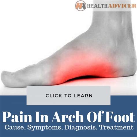 Pain In Arch Of Foot: Causes, Picture, Symptoms And Treatment