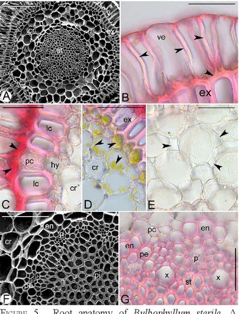 Figure 2 from Vegetative anatomy of the orchid Bulbophyllum sterile ...