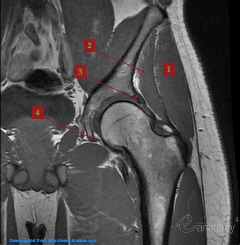 normal hip MRI coronal view (class) Diagram | Quizlet