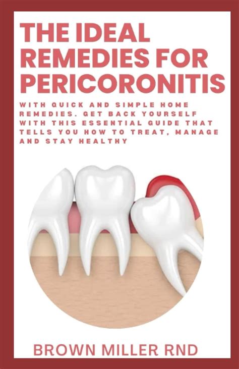 The Ideal Remedies For Pericoronitis: With Quick and Simple Home Remdies. Get Back Yourself With ...