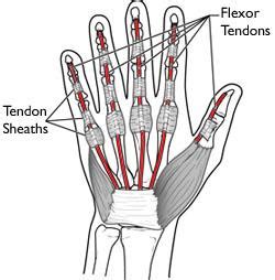 Flexor Tendon Injuries - OrthoInfo - AAOS