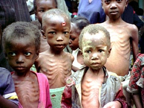 UNICEF: Over 2m Nigerian Children Suffer From Acute Malnutrition