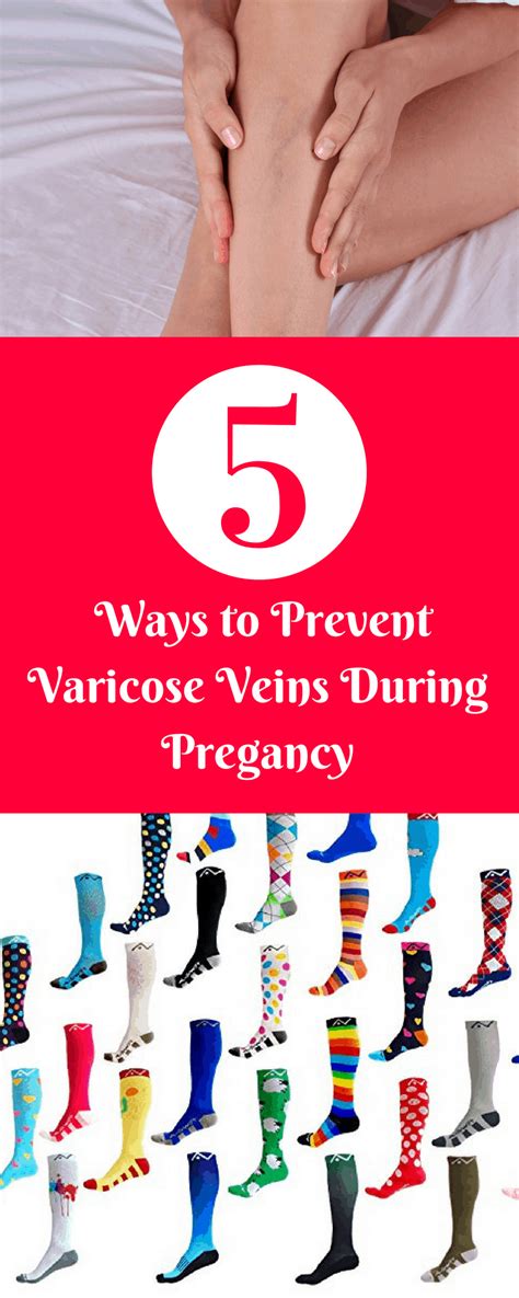 How To Deal With Varicose Veins During Pregnancy » Maternity Comfort Solutions