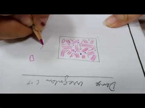 Learn to draw dense irregular connective tissue ( CT) histology diagram ( Microscopic Anatomy ...