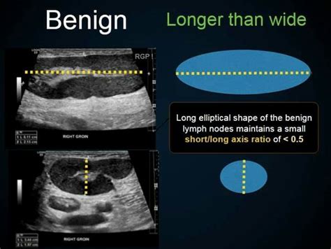 Ultrasound School, Medical Radiography, Sonography Student, Ultrasound Sonography, Ultrasound ...